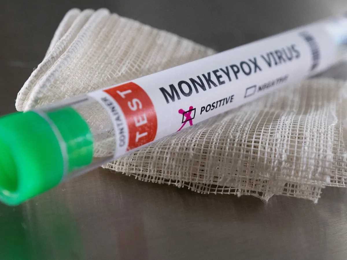 न्यूयॉर्क की गुजारिश, मंकीपॉक्स वायरस का नाम बदला जाए